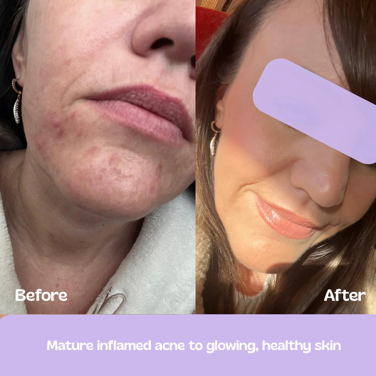Glow Up (Skin & Hair Patch)