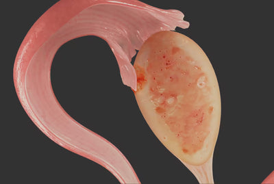 Vaginal Microbiome and Fertility: How Are They Linked?