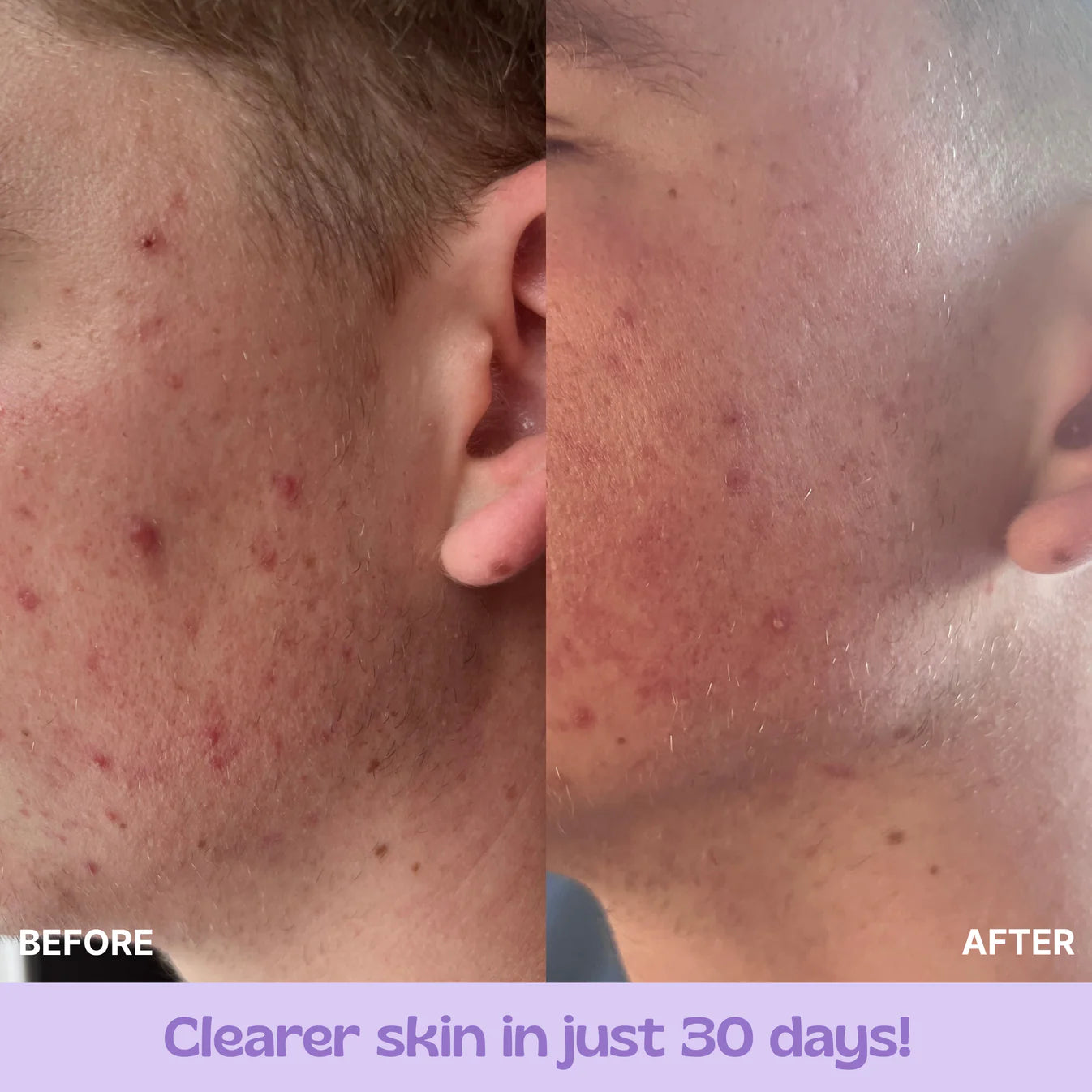 Glow Up (Skin & Hair Patch)