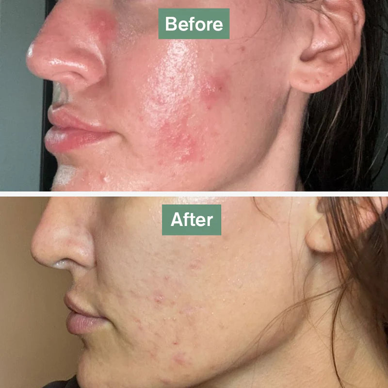 Skin Saviour® (Skin Health Supplement)